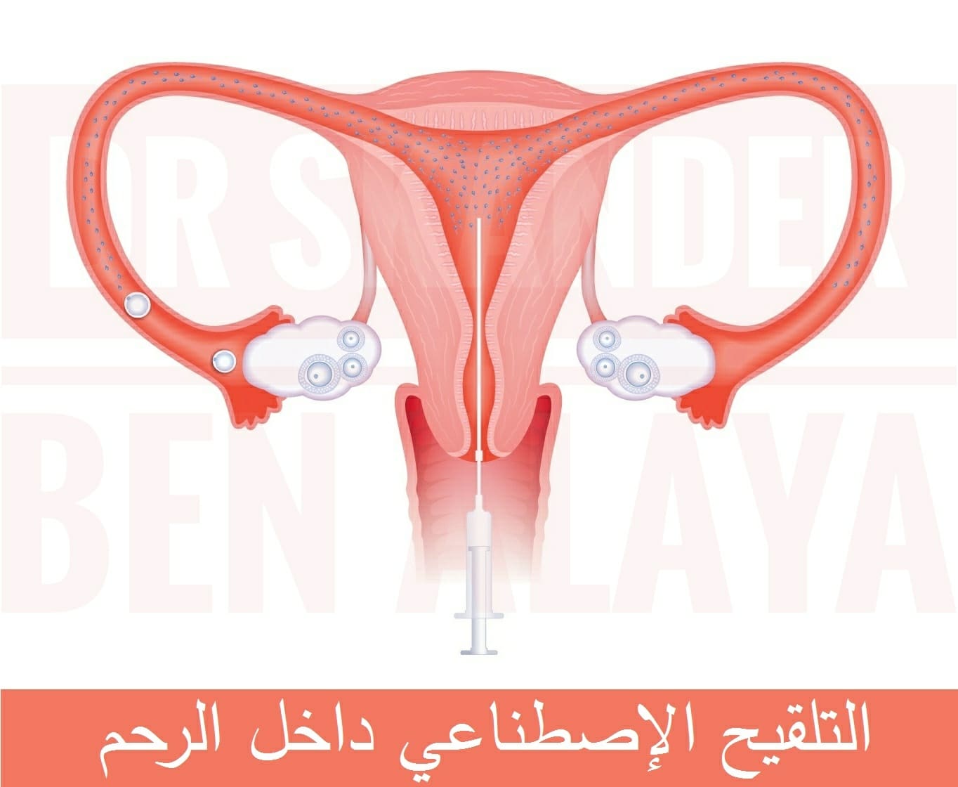 علاج العقم وتأخر الإنجاب بإستخدام تقنيات المساعدة على الإنجاب