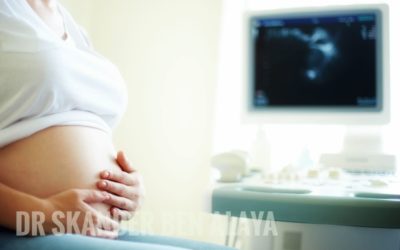 Cerclage du col utérin pendant la grossesse: Indications et déroulement