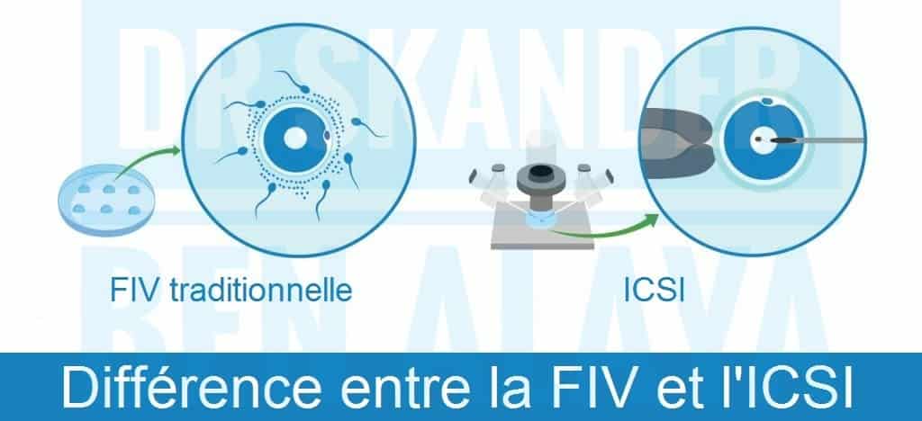 FIV et ICS I: FIV traditionnelle et FIV-ICSI