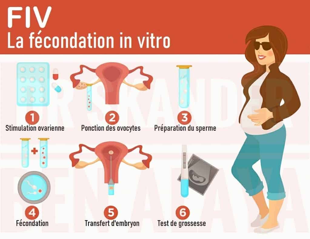 Comment se déroule la fécondation in vitro conventionnelle (FIV) ?