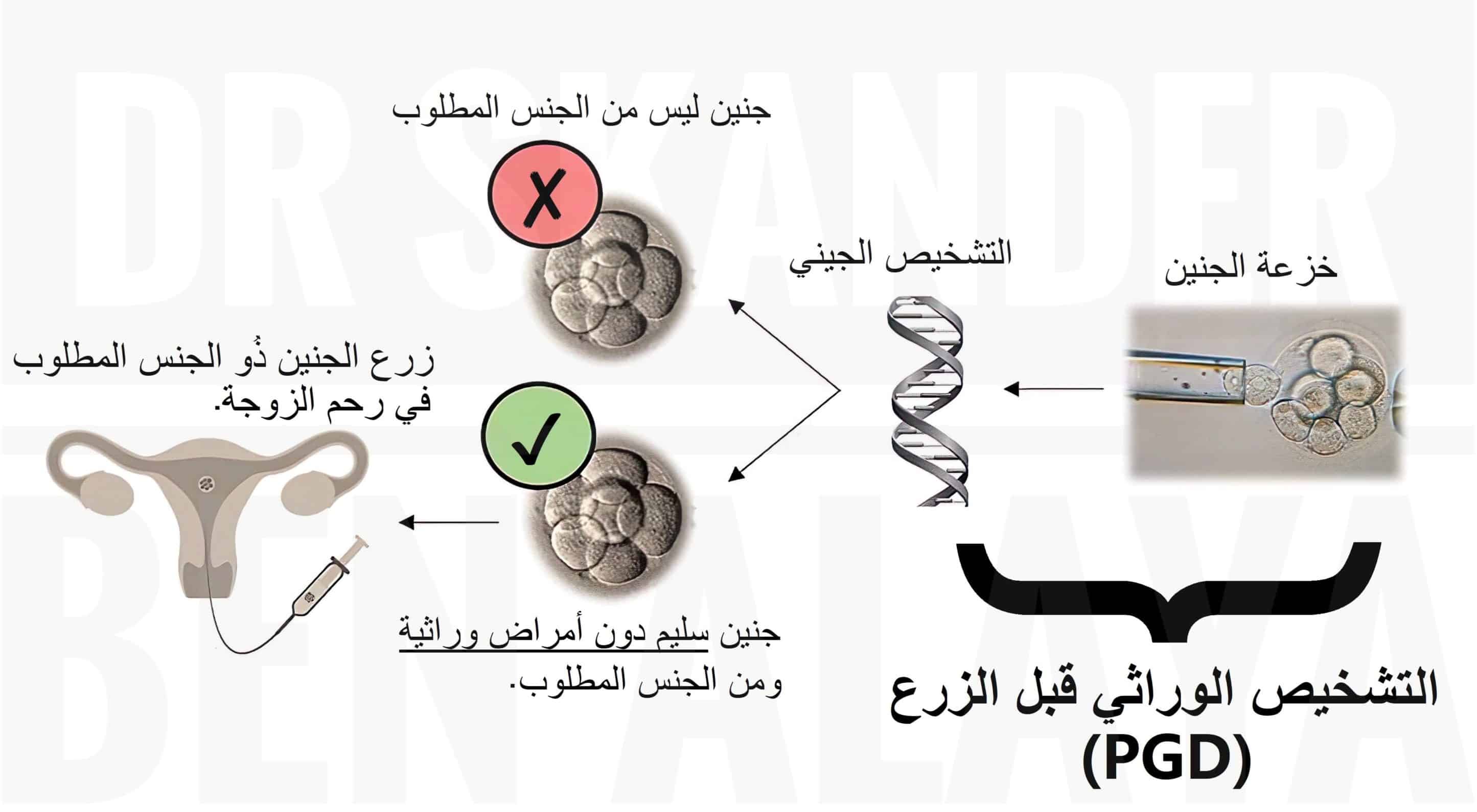 تحديد وإختيار جنس الجنين بإستخدام تقنية التشخيص الوراثي للأجنة قبل الزرع.