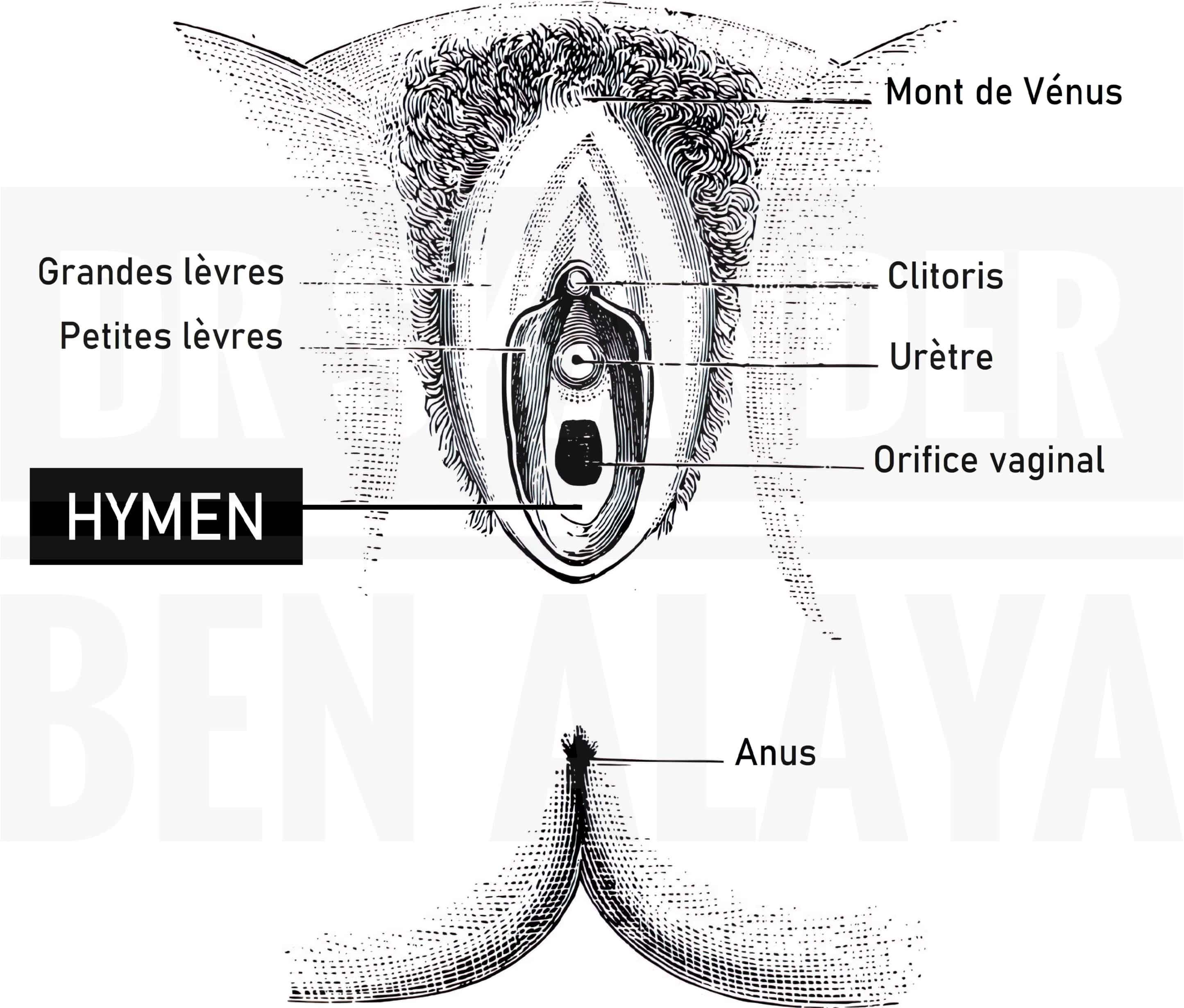 Hymen, appelé également membrane hyménale ou encore couronne vaginale.