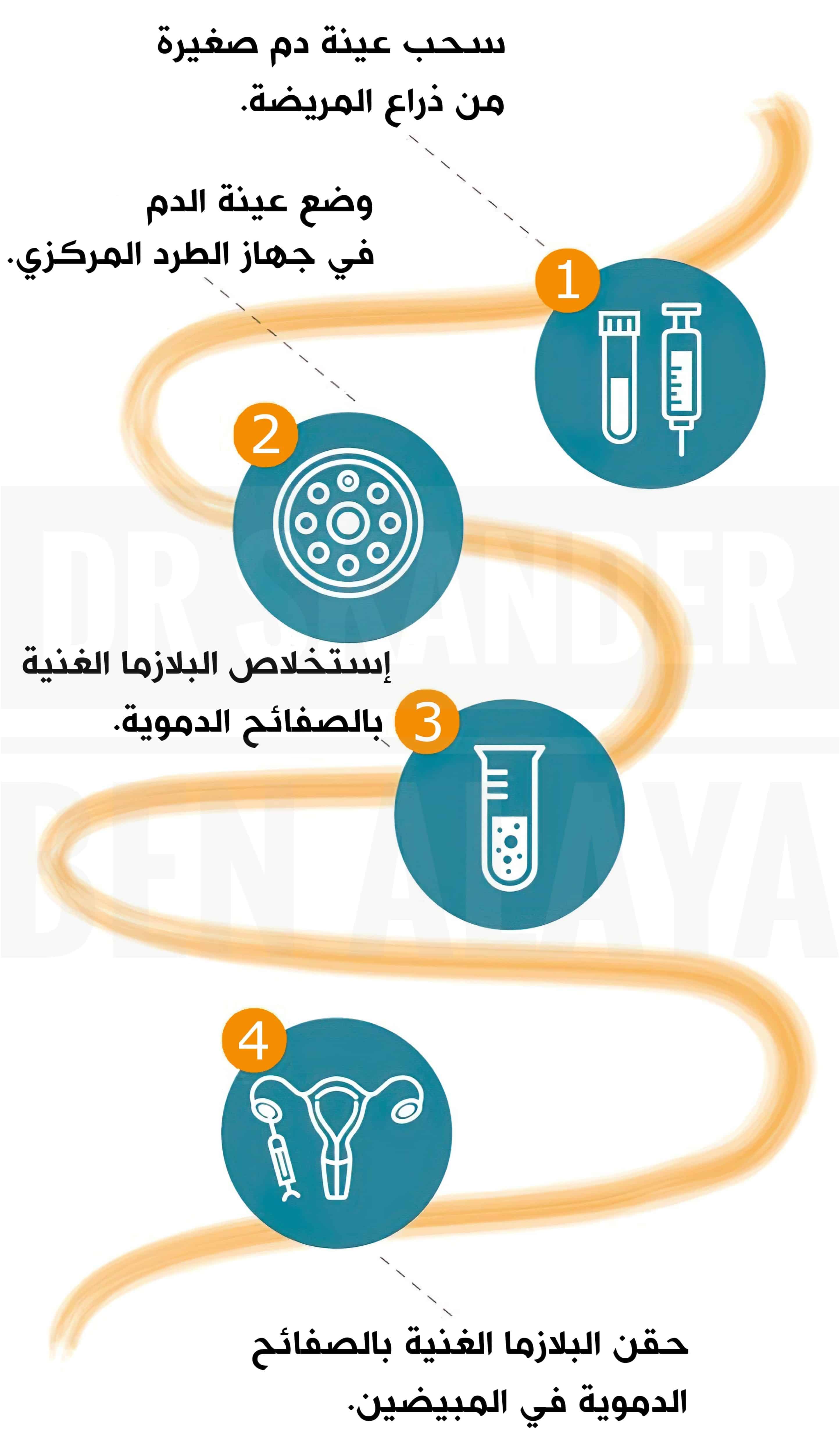 حقن البلازما الغنية بالصفائح الدموية وعوامل النمو في المبيض لزيادة فرص الحمل.