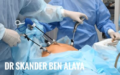 La chirurgie endoscopique gynécologique : tout ce qu’il faut savoir